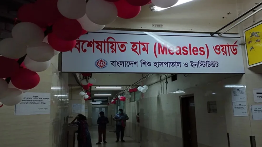 হামের উপসর্গ নিয়ে তিনজনের মৃত্যু, আক্রান্ত ১০৬৪